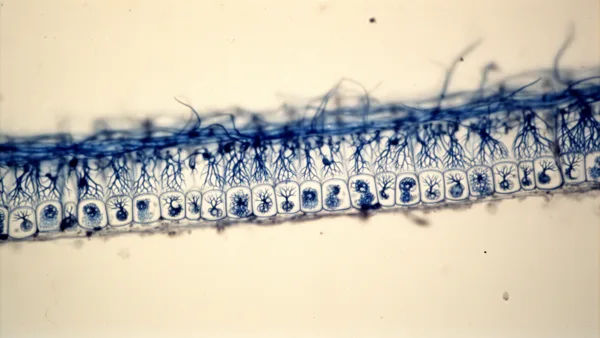 Microscopic view of blue-stained plant cells with intricate cellular structures on a beige background.